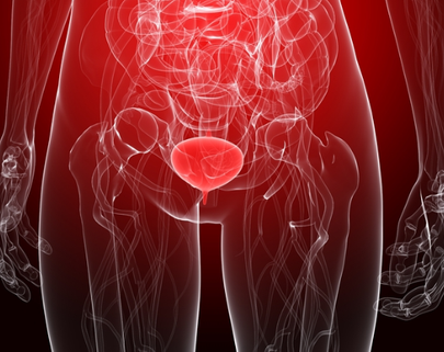 Urinary Tract Infection
