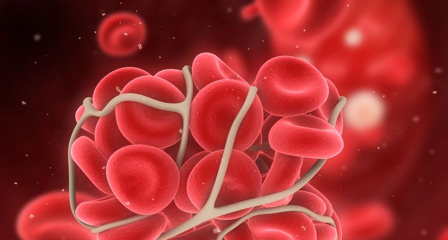 Common Signs and Symptoms of a Blood Clot ActiveBeat
