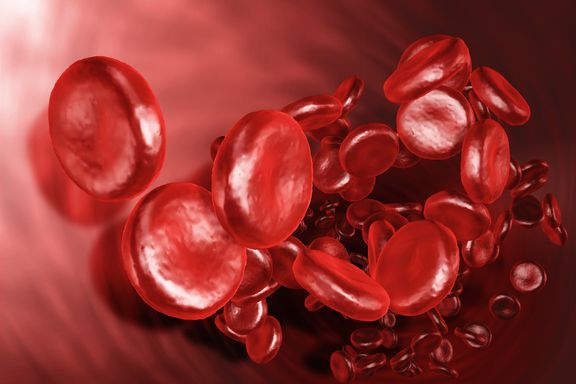 Die Top 7 Risikofaktoren von Blutgerinnseln