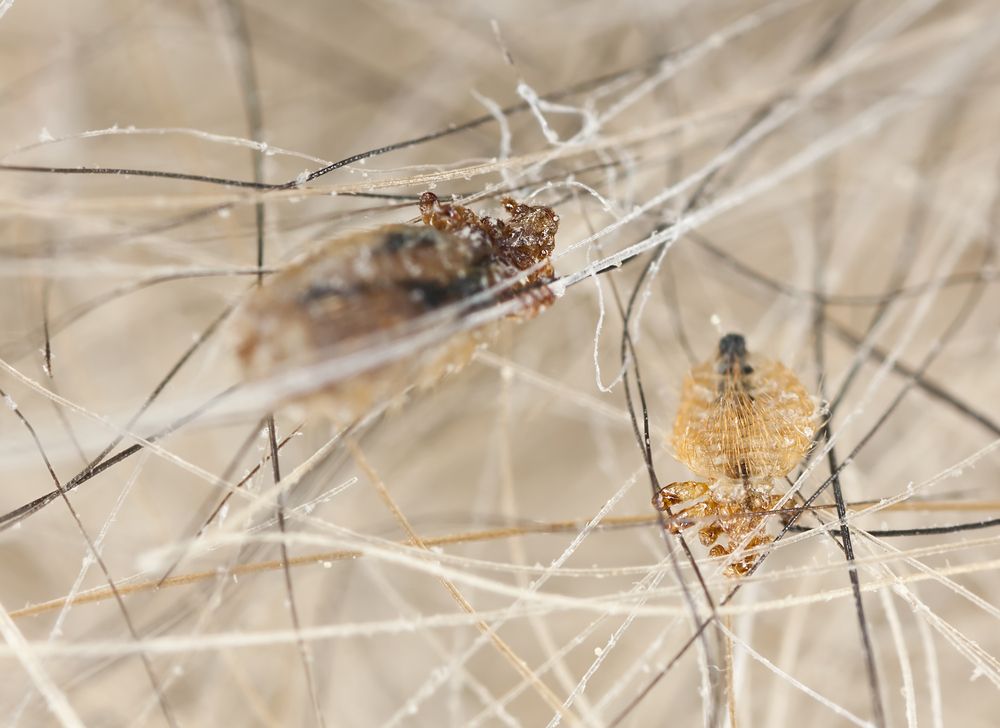 Popular Lice Treatment Can Cause Cancer, WHO Says - ActiveBeat