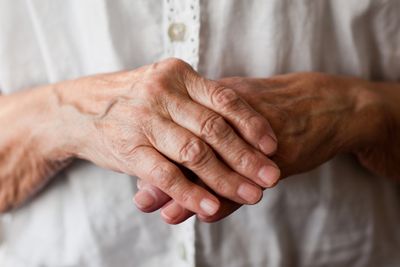 Arthritis