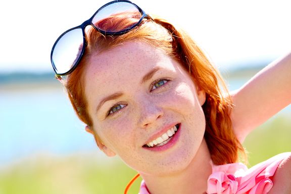 Redheads At Risk For Melanoma: Skin Cancer Can Develop Without The Sun