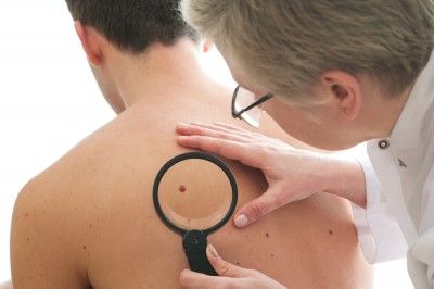Mole
