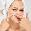 Best Ways to Prevent Acne: Avoid Breakouts With These Tips!