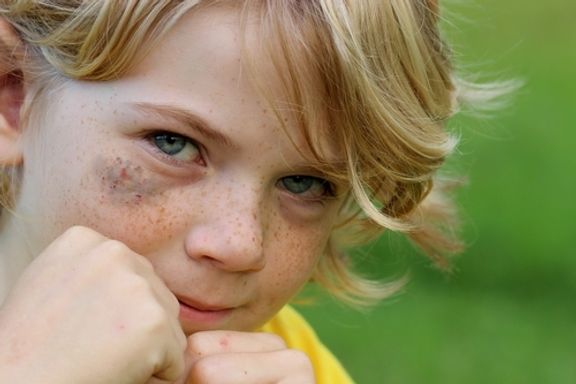 10 Segnali che Indicano che Vostro Figlio è Vittima di Bullismo