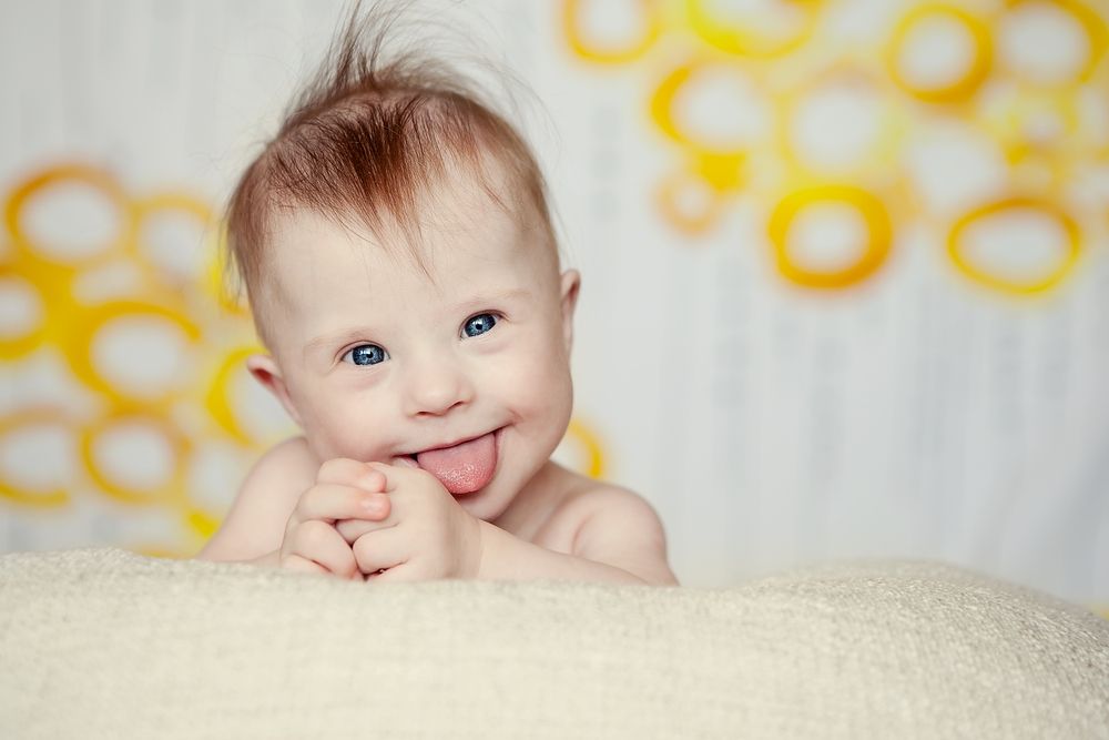 The Most Common Genetic Disorders ActiveBeat