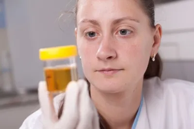 urine sample