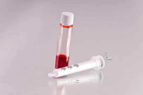 Les 10 Examens Sanguins Les Plus Courants et Leur Usage