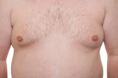 man boobs
