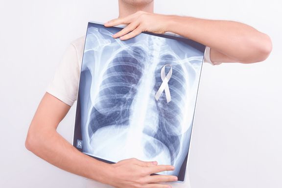 Câncer de pulmão: primeiros sinais e sintomas