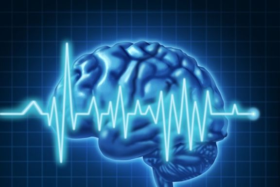 Seis problemas de salud que elevan los riesgos de tener convulsiones no epilépticas