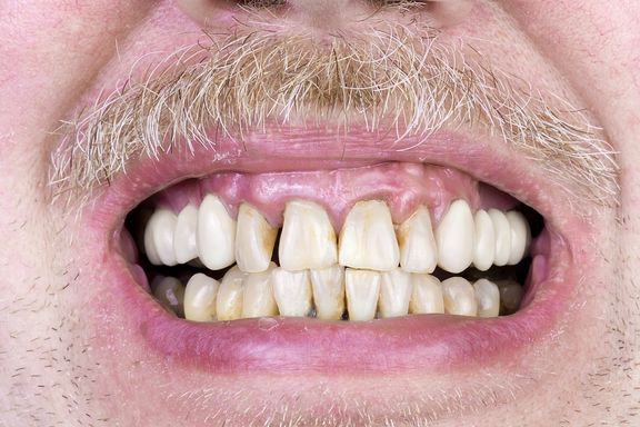 10 Señales de que Debe Visitar a su Dentista