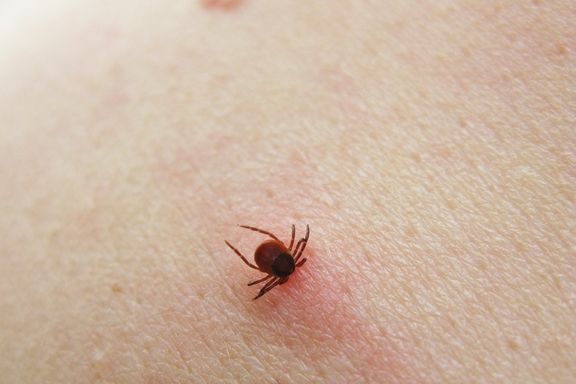 Los hechos y síntomas de la enfermedad de Lyme