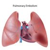 Consejos para vivir con Hipertensión Arterial Pulmonar