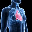 Treatment Options for Pulmonary Arterial Hypertension