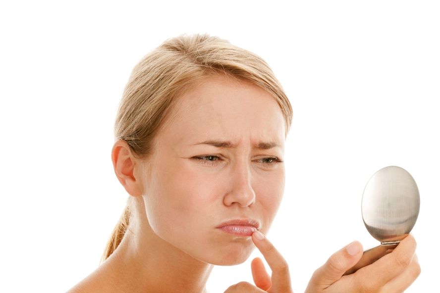 Seis factores desencadenantes de los herpes labiales