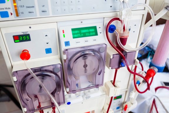 World's First Infant Kidney Dialysis Machine Saves Newborn's Life