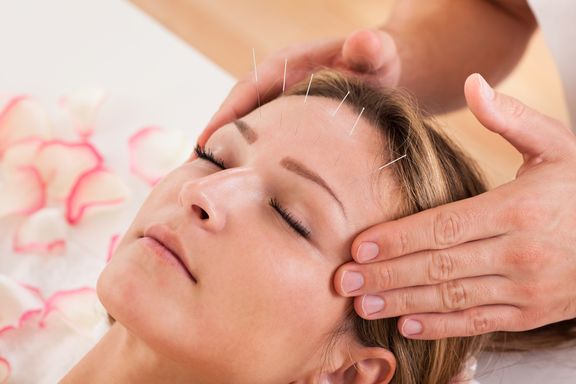 8 Things Most People Don’t Know About Acupuncture