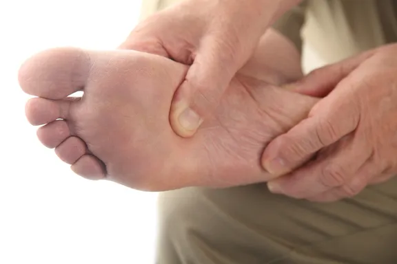 5 problèmes de santé associés aux pieds douloureux