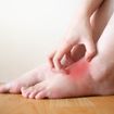 Itchy, Burning Symptoms of Athlete's Foot