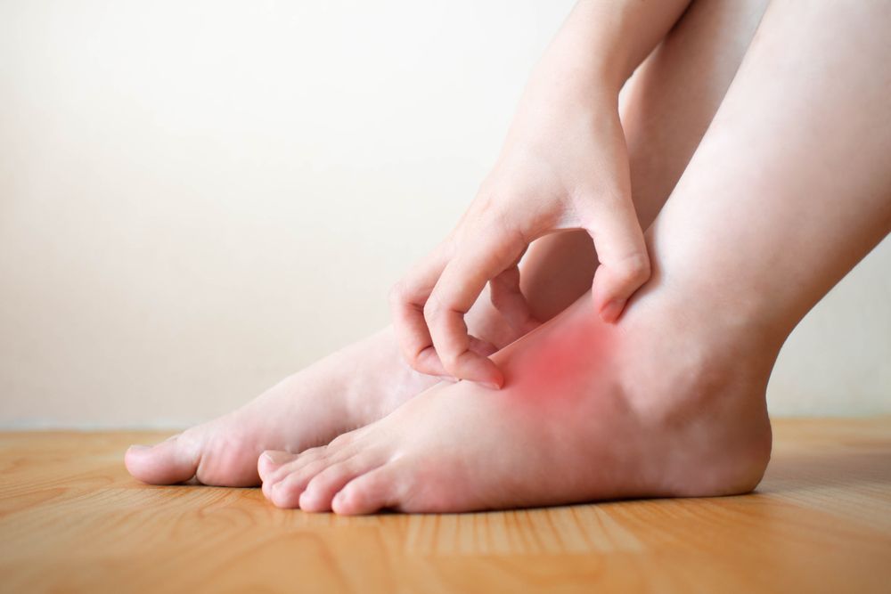 Itchy, Burning Symptoms of Athlete's Foot ActiveBeat
