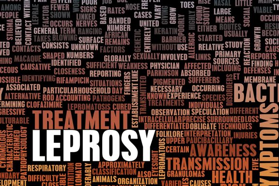 New Cases of Leprosy Emerge in Florida