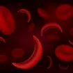 El ABC de la anemia drepanocítica