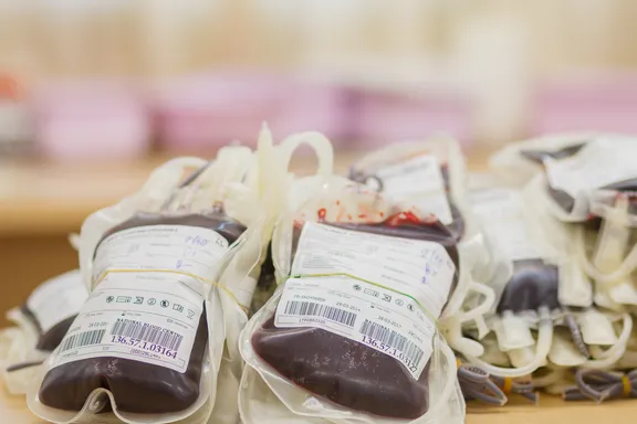 Time to Lift Lifetime Ban on Blood Donations by Gay Men: FDA