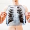 Health Facts About Walking Pneumonia