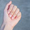 Common Health Problems Related to Fingernails