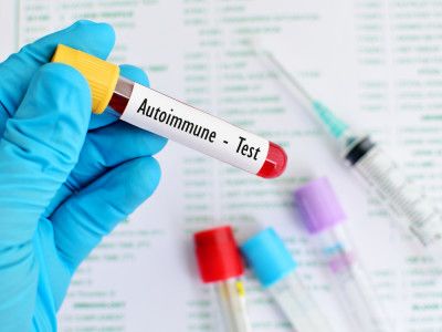 autoimmune test