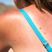 Factors That Increase Your Risk of Skin Cancer