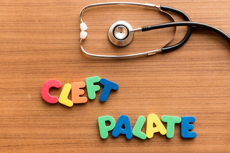 6 Medical Facts on Cleft Palate or Cleft Lip