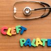 6 Medical Facts on Cleft Palate or Cleft Lip