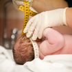 6 Medical Facts on Microcephaly