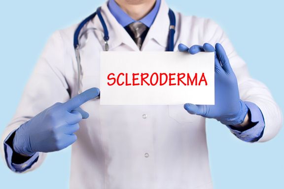 Scleroderma: What You Need to Know