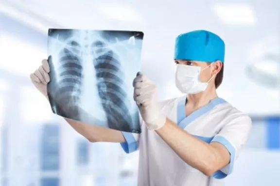 Symptoms and Risk Factors of Tuberculosis
