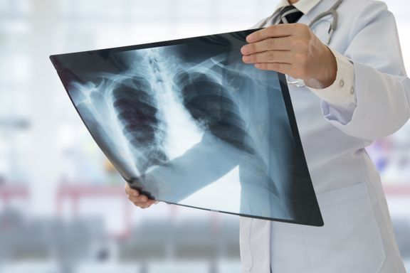 Identifying The Major Types of Pneumonia by Cause