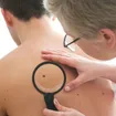 Signs and Symptoms of Non-Melanoma Skin Cancer