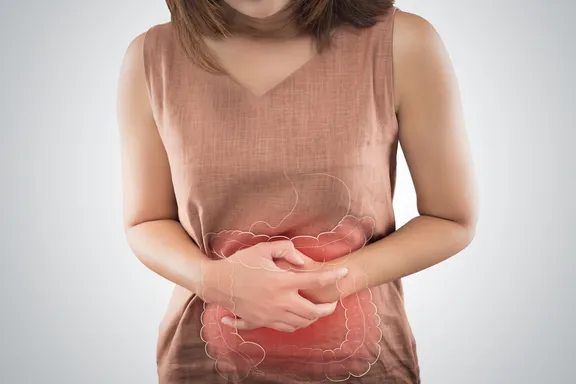 Signs and Symptoms of Ulcerative Colitis