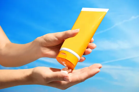 Sun Poisoning: Symptoms, Causes, and Treatments
