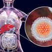 Hepatitis C: Facts You Should Know