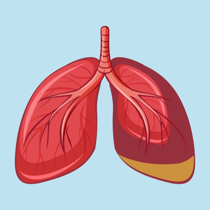 mesothelioma berep4