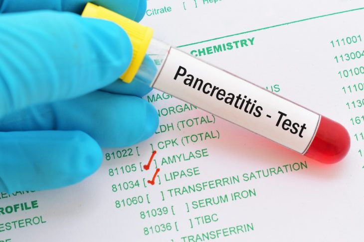 Acute Pancreatitis Vs Chronic Pancreatitis Whats The Difference