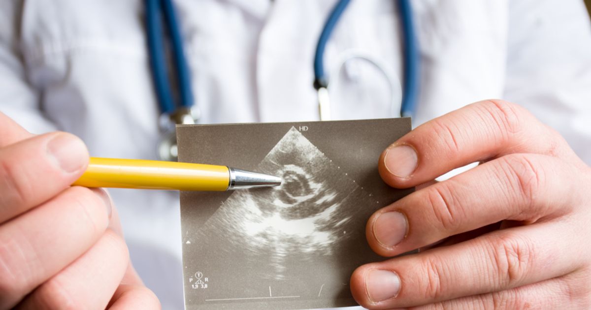 Leaky Heart Valve Symptoms, Causes, and Treatments ActiveBeat