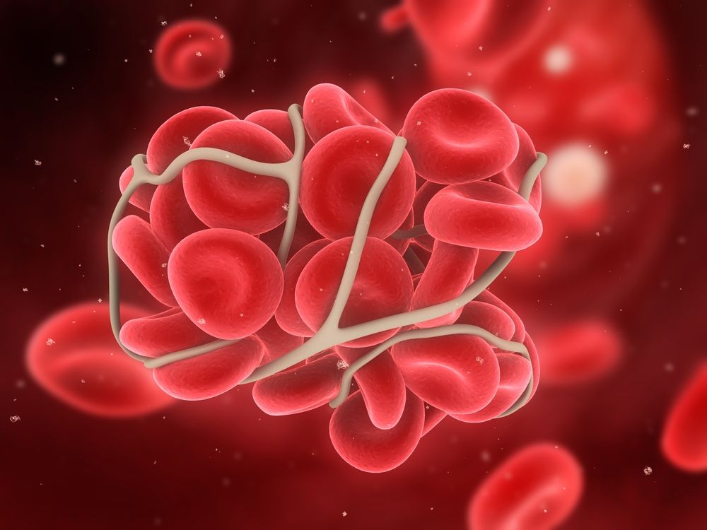 Health Facts to Know About Blood Clots ActiveBeat