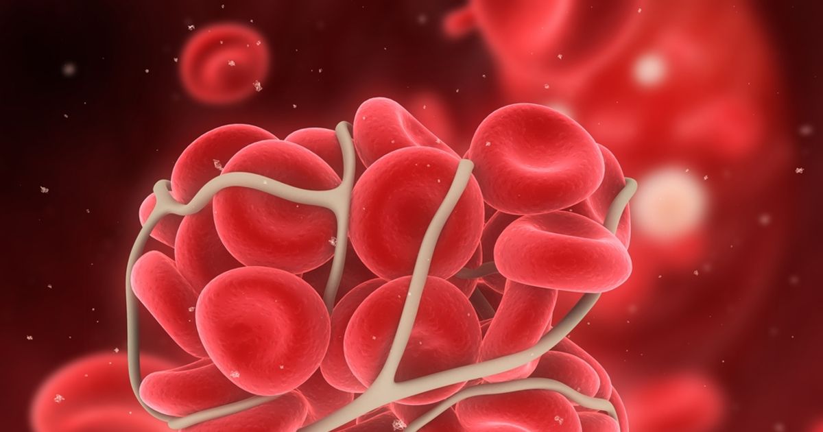 Signs Of A Blood Clot (Plus Risk Factors, Treatment Options & More