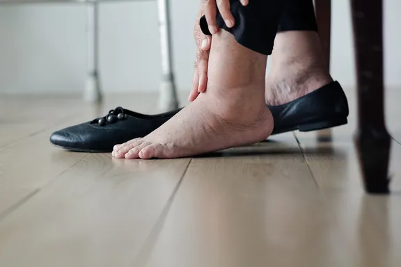 Causes courantes des pieds gonflés