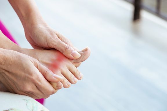 The Most Common Symptoms of Gout - ActiveBeat