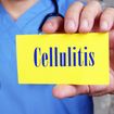 What’s Cellulitis? A Dermatologist Explains